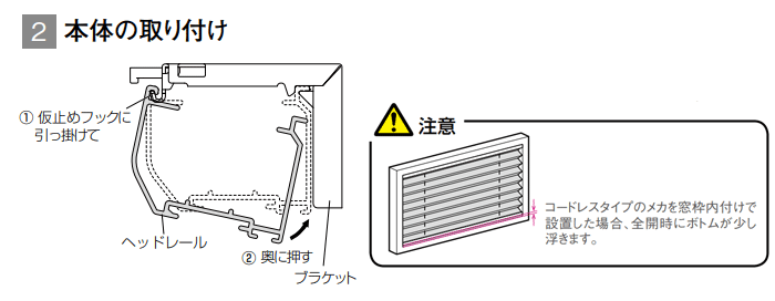 本体の取付